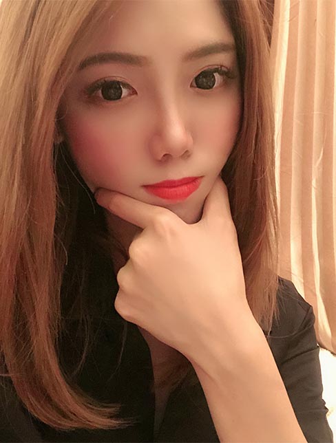 肋軟骨鼻綜合案例:術(shù)后效果