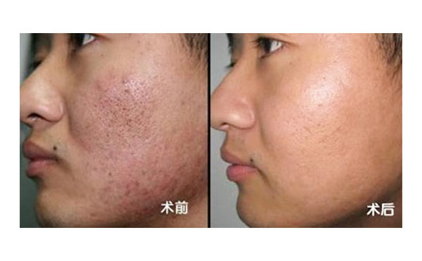 黑臉娃娃有風(fēng)險嗎？