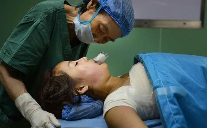 假體隆胸效果自然嗎？能維持多久？