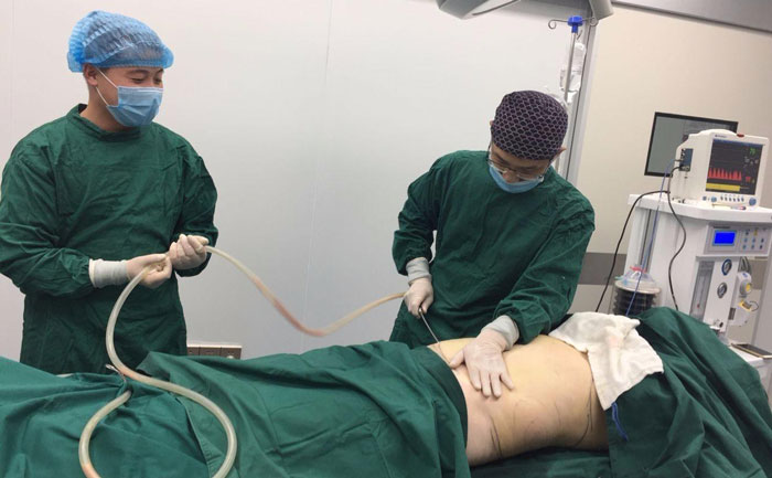 吸脂提臀線是怎么樣的？吸脂提臀多少錢？