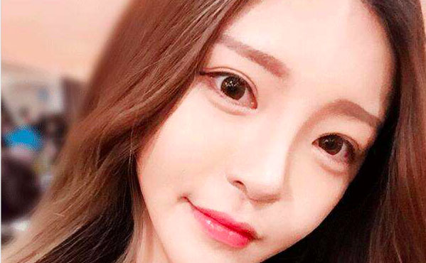 韓式開眼角的費用是多少？