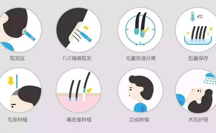 體毛種植的方法有哪些？
