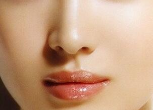 鼻子和下巴可以同時(shí)手術(shù)嗎？