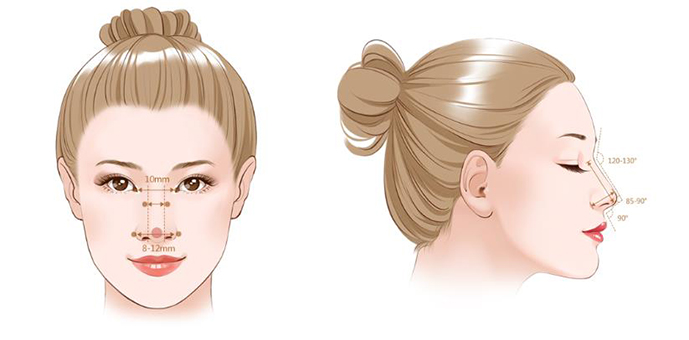 隆鼻手術(shù)示意圖