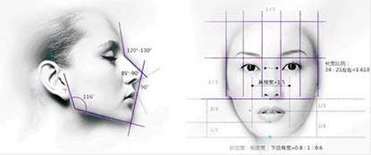 V臉成型術(shù)手術(shù)示意圖