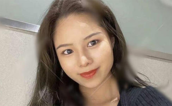 鼻再造手術(shù)成功率高嗎？