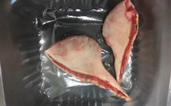 濟(jì)南海峽整形：下頜角整形術(shù)后就該這么做