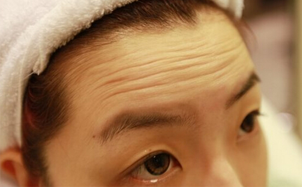 抬頭紋是怎么形成的？