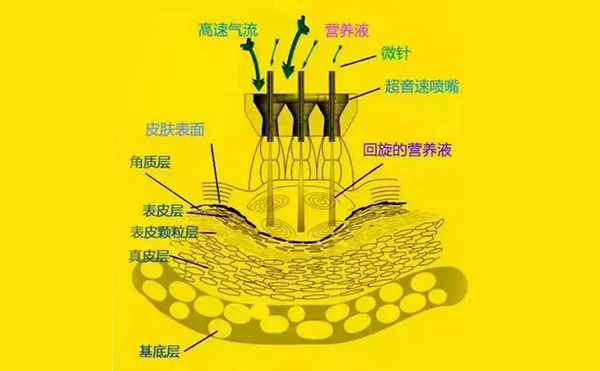  無針水光針是怎么做的?效果怎么樣?