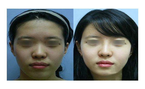 做白瓷娃娃多少錢？