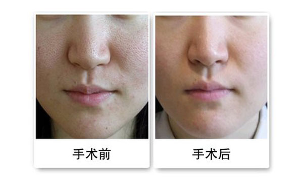 黑臉娃娃能維持多久？