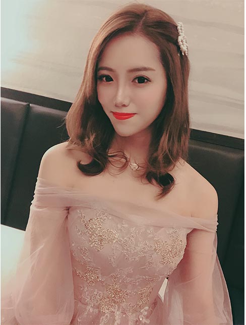 肋軟骨鼻綜合案例:術(shù)后效果1