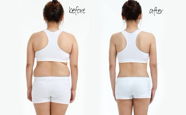 背部吸脂手術(shù)疼不疼？