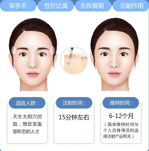 豐太陽穴多少錢？