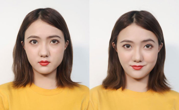 大小臉是什么原因造成的？大小臉怎么辦怎么矯正？