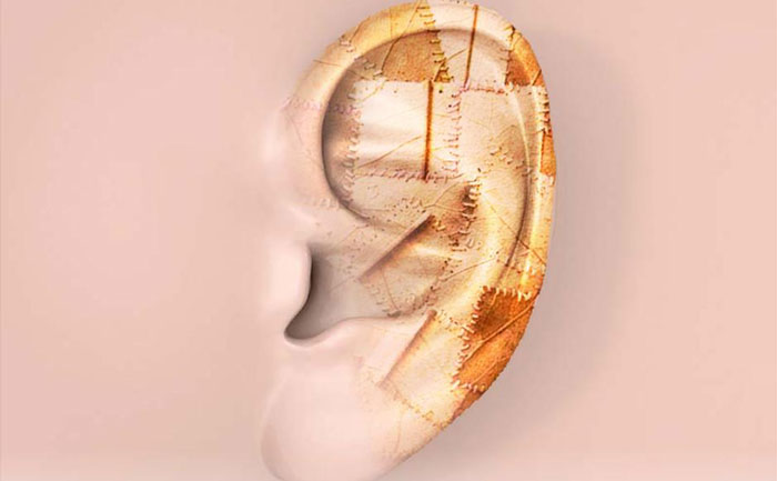 耳再造手術(shù)對(duì)軟骨有影響嗎？