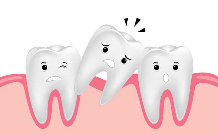 牙齒松動還能恢復(fù)嗎？