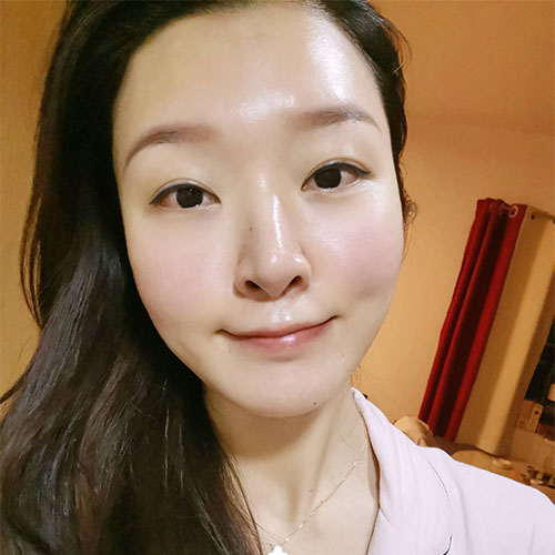 熱拉提手術效果圖2