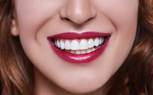 牙齒貼面怎么做？