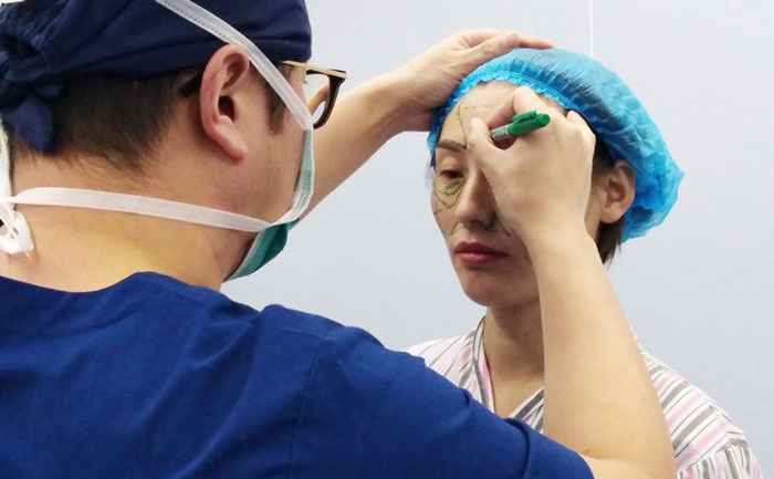 自體脂肪填充面部能保持多長(zhǎng)時(shí)間？