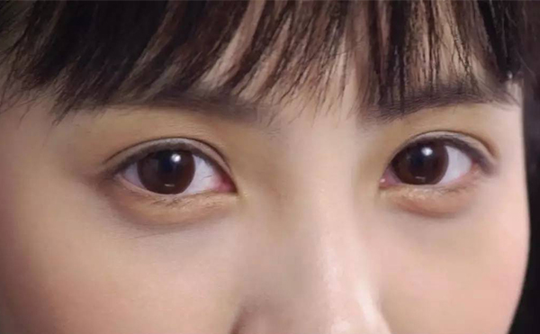 豐臥蠶的手術(shù)過程是什么?術(shù)后會不會留疤?