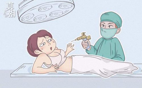 全身脂肪大概要多少錢？