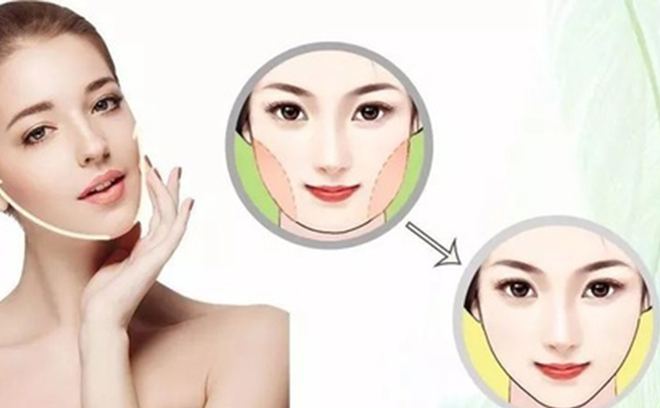 做下頜角磨骨皮膚會(huì)松弛嗎？怎么恢復(fù)？