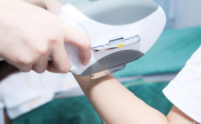 手臂脫毛多少錢？手臂脫毛幾次干凈？