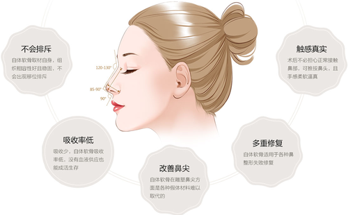 自體軟骨隆鼻可以永久的嗎？