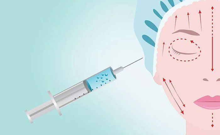 注射除皺針大概多少錢？