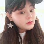 鼻基底整形案例對比4