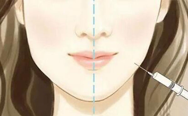 瘦臉針可能會(huì)出現(xiàn)什么風(fēng)險(xiǎn)？