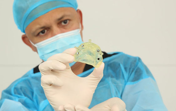 牙冠修復(fù)后能堅持幾年？