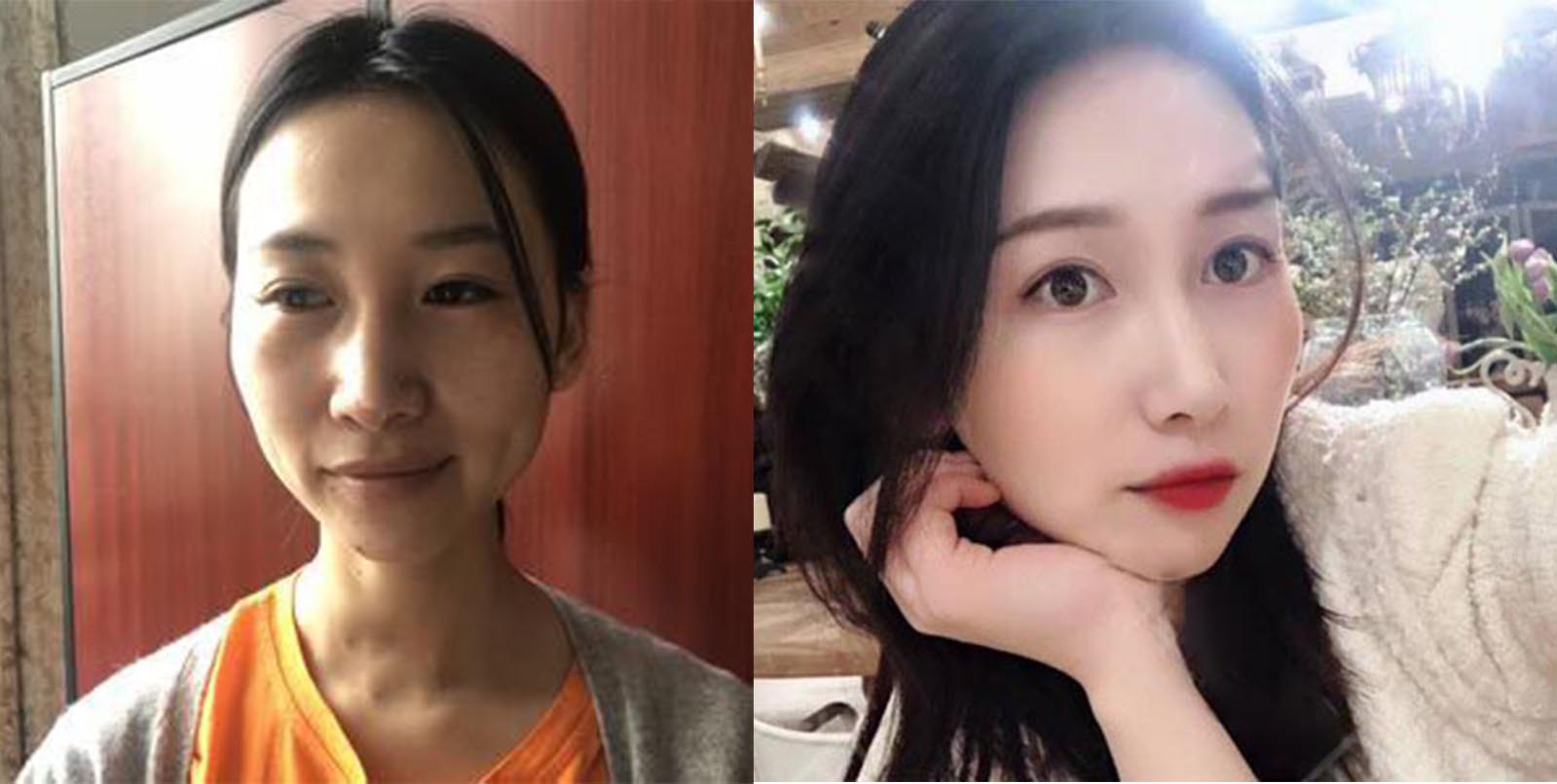 上海渝悅美聯(lián)臣磨骨