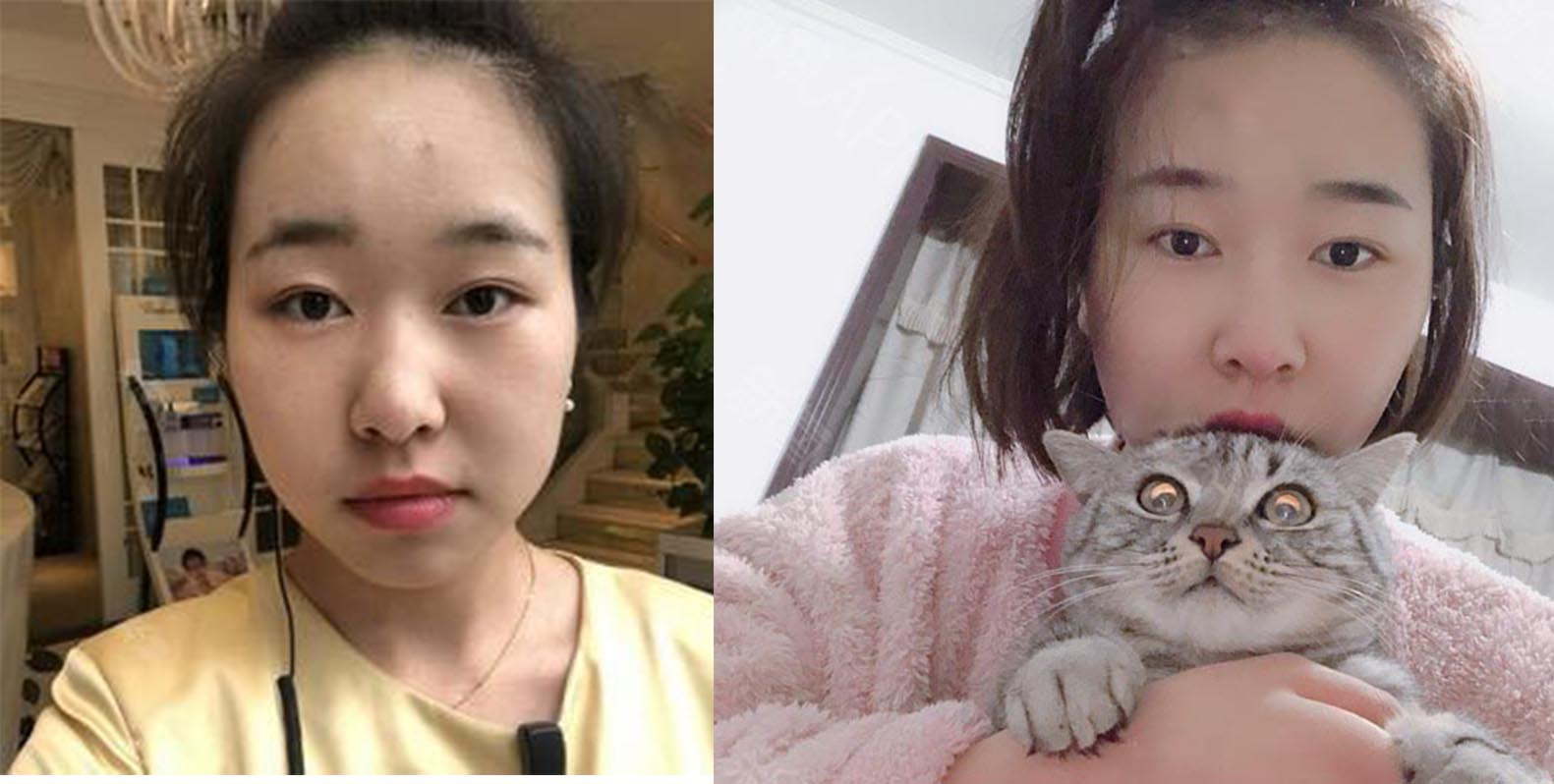 面部填充效果對(duì)比圖