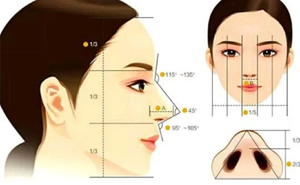 假體隆鼻恢復(fù)期要多長時間？假體隆鼻不滿意還能做注射隆鼻改善嗎？