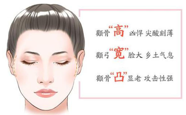 顴骨內(nèi)推整形適宜人群？