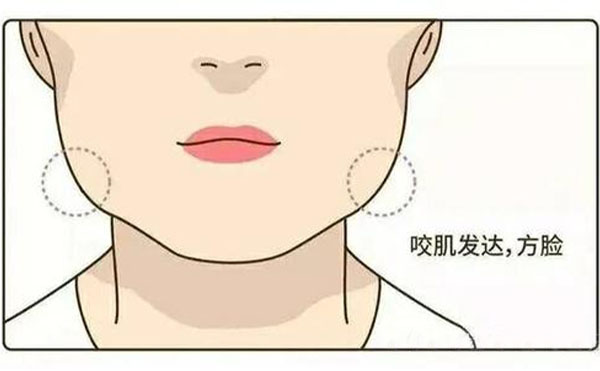 為什么咬肌會(huì)肥大？