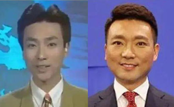 治療咬肌肥大的方法有哪些？