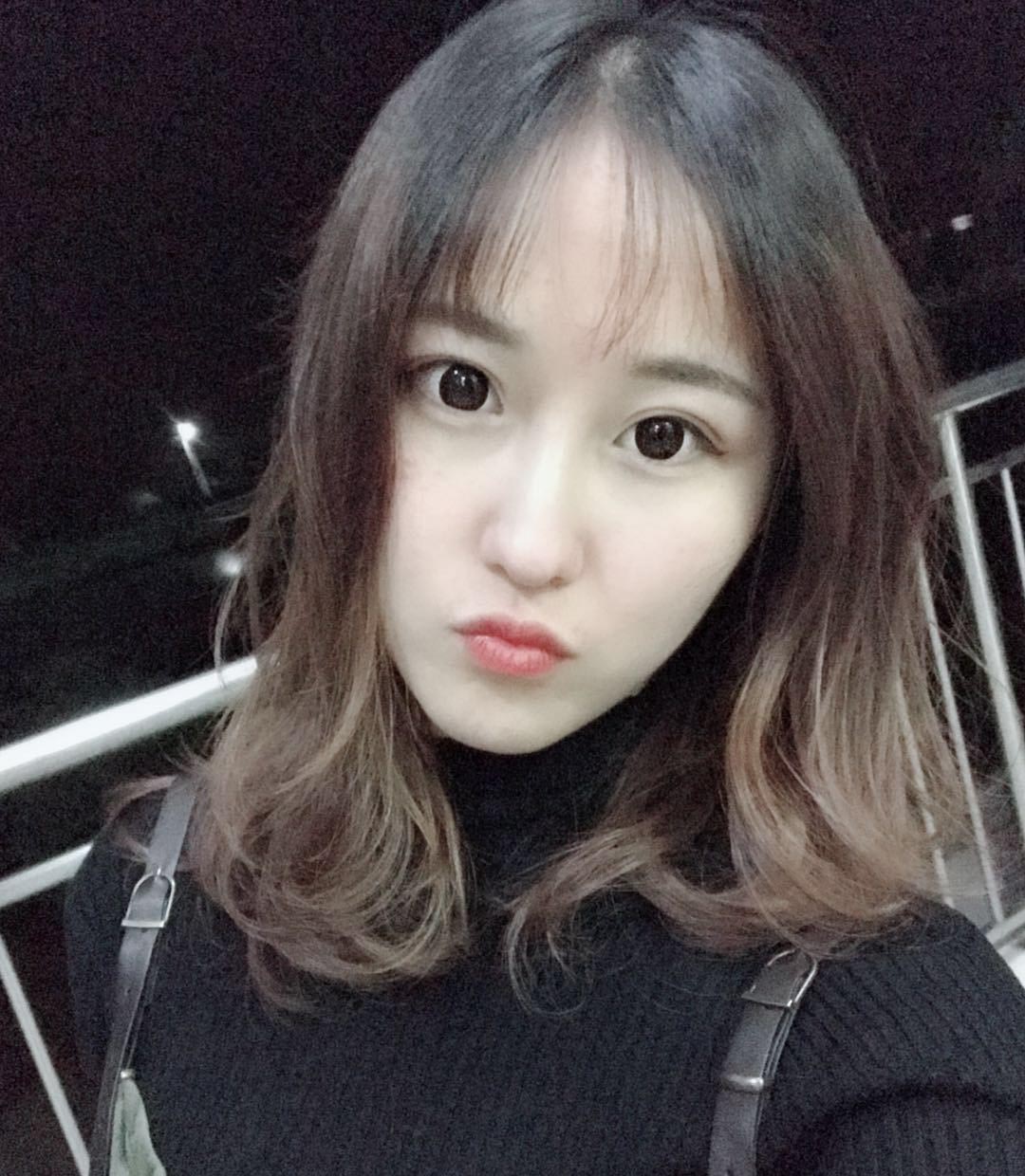 雙眼皮修復(fù)效果對比圖3