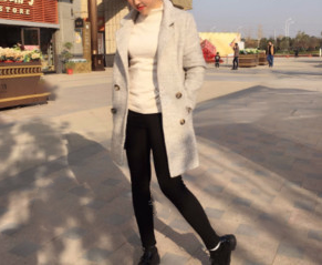 太原時光整形王國軍大腿吸脂案例3