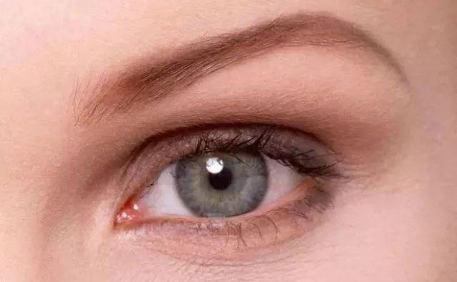 歐式雙眼皮是什么樣的？