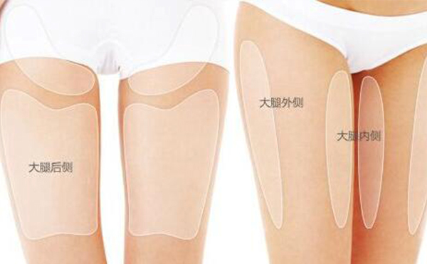 大腿吸脂的部位有哪些？