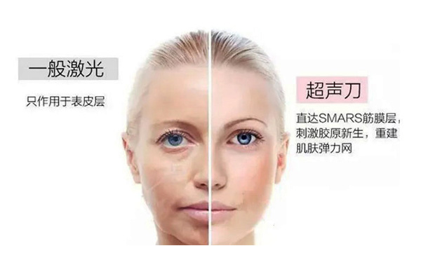超聲刀有什么優(yōu)勢？