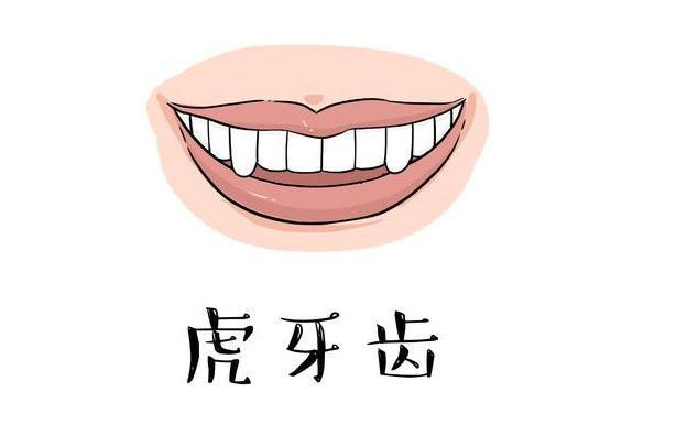 虎牙矯正需要多久？