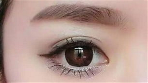 切眉手術(shù)要多長(zhǎng)時(shí)間恢復(fù)？