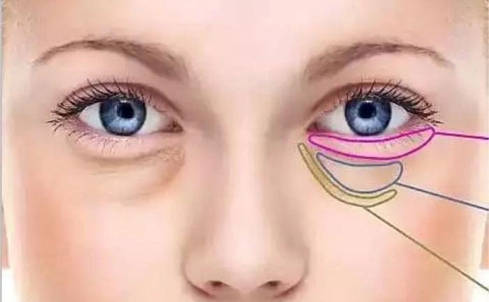 臥蠶跟眼袋怎么區(qū)分？臥蠶和眼袋有什么區(qū)別？