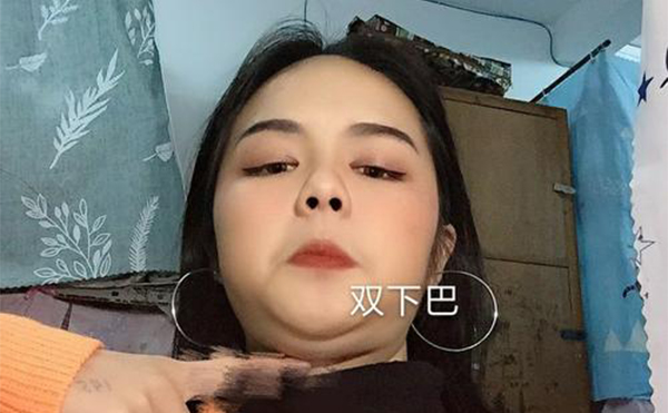 吸脂去雙下巴和溶脂瘦下巴有什么區(qū)別？