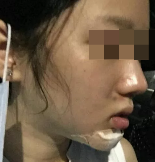 輪廓立體,更自信