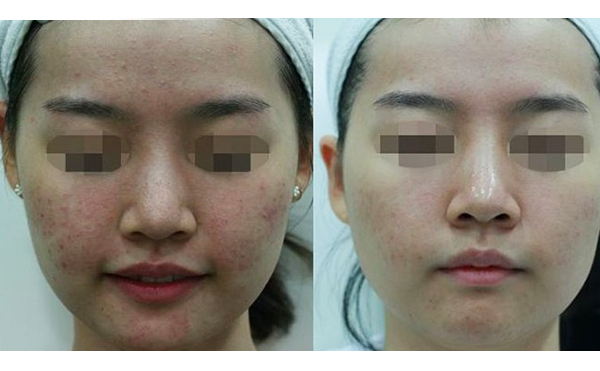 白瓷娃娃是怎么做的?有什么優(yōu)勢(shì)?